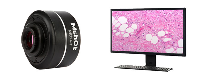 顯微鏡相機(jī)MV-6T 1600萬(wàn)超高分辨率顯微數(shù)碼相機(jī) 64M內(nèi)存